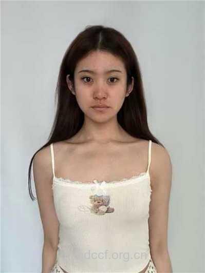 39岁母亲隆胸成瘾 警惕隆胸五大后遗症