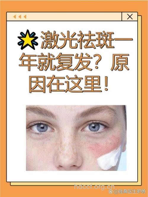 光子治疗后色斑为何会加深