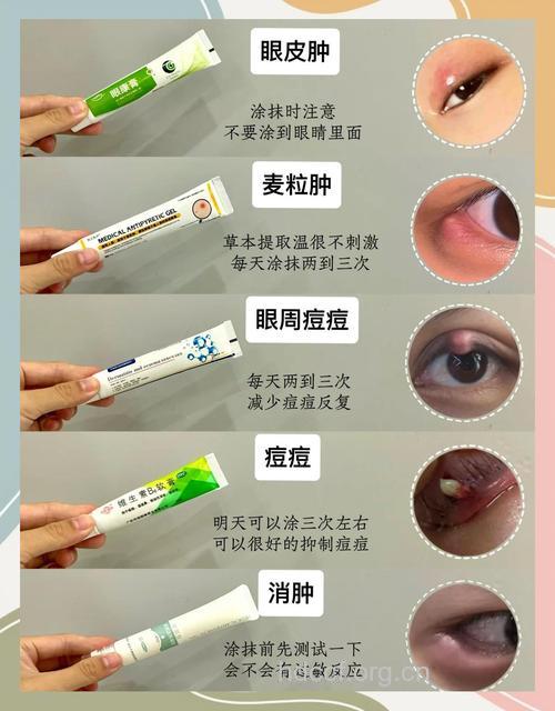 去痘痘用消炎眼药水可以吗