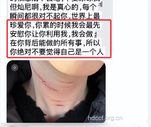 为追男神休学整容 表白被拒挥刀自残