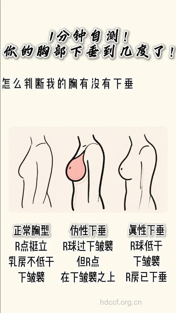 人老胸先垂 女人六个部位看衰老程度