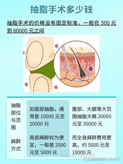 专家解答:吸脂手术相关问题