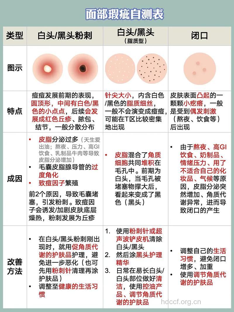 如何彻底消灭面部粉刺