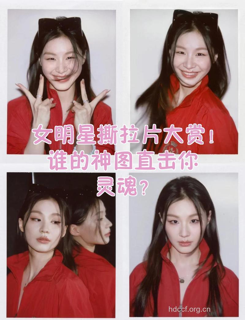 明星最爱的几种拉皮术全解