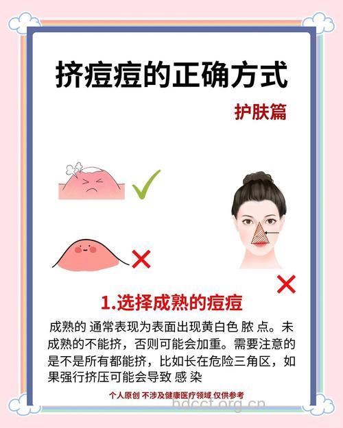 挤痘痘不留痕安全守则