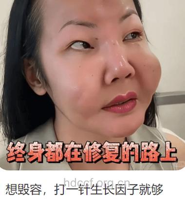 提醒：面部吸脂小心成毁容