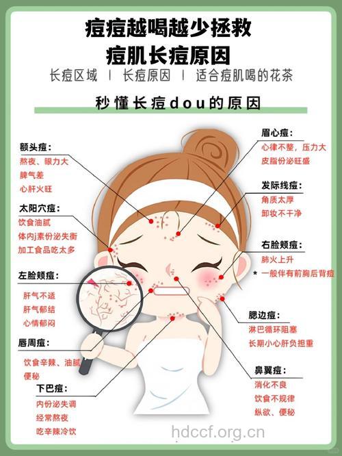 成人长痘痘的原因