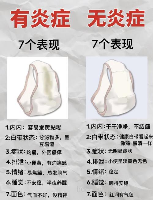 女人不能忽视白带多的种种原因