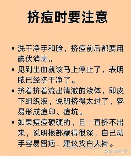 挤痘痘后的怎么护理