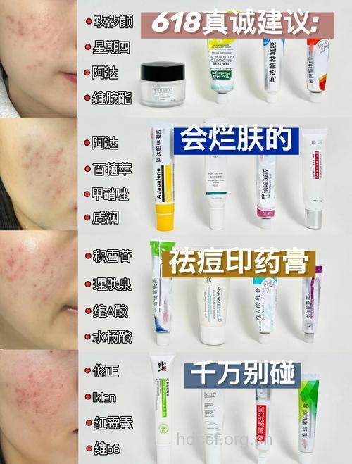 MM的痘痘克星是什么