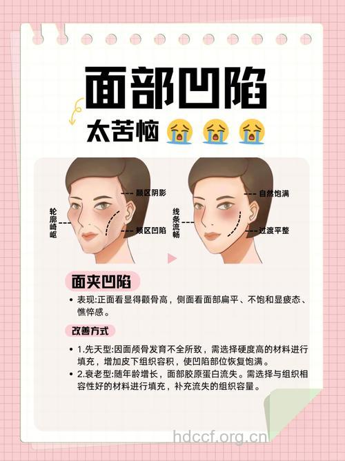 酒窝整形走俏 常见风险要警惕