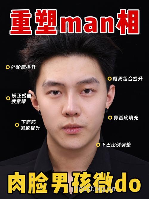 男性整形蔚然成风 切不可太盲目