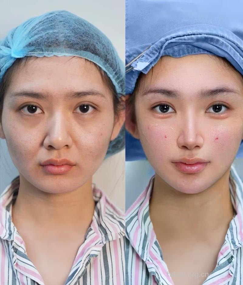 盘点时下最流行的八大整形术