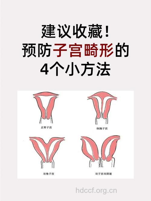 子宫发育异常的治疗方法
