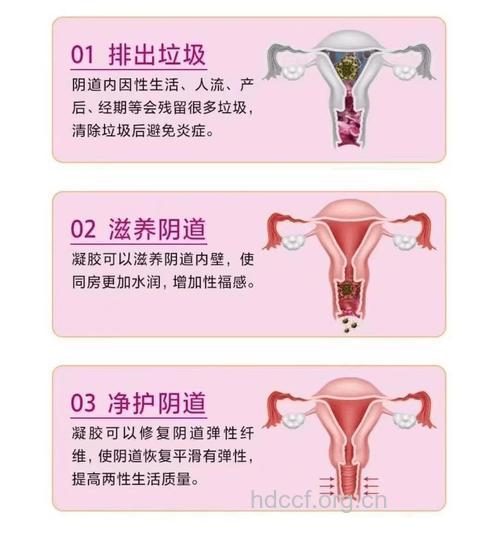 女性须知! 阴道保健小常识