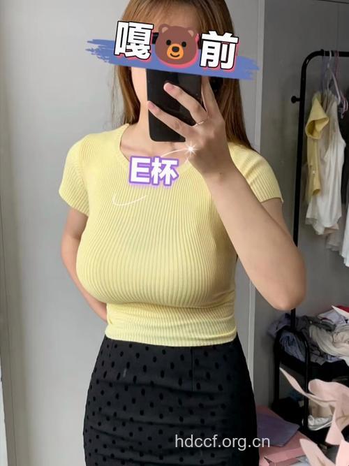 不爱隆胸爱缩胸 缩胸术成新风尚