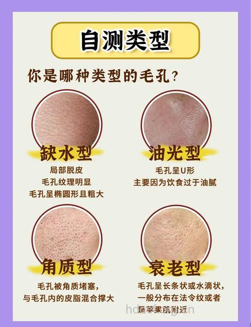 男女都应了解的毛孔问题