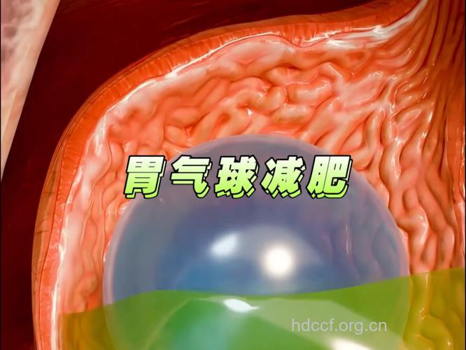 最奇葩的减肥方法：吞气球减食欲