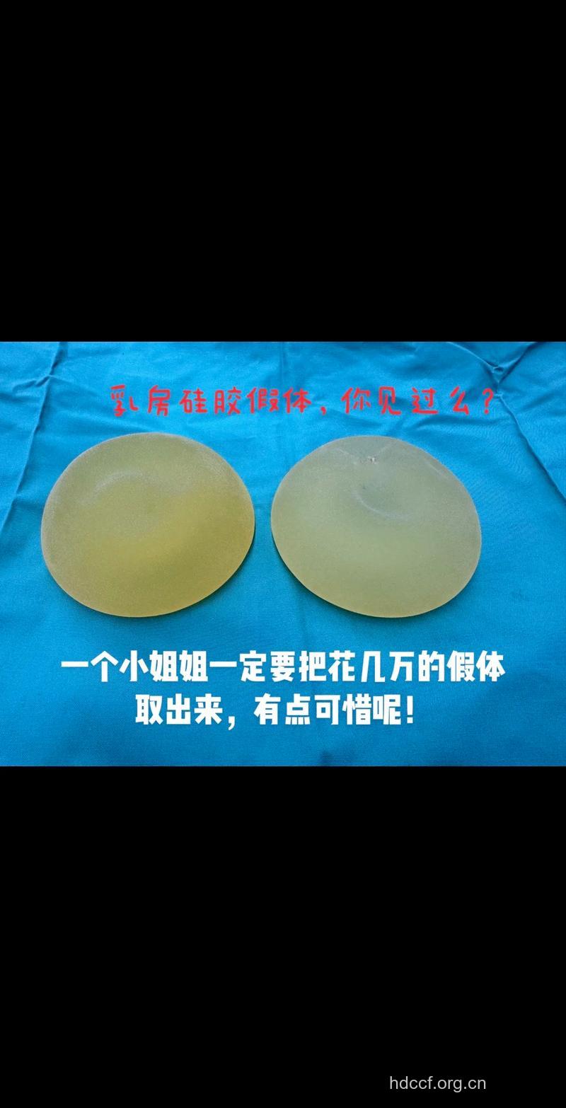 硅胶隆胸盛行 哪些人不适合硅胶假体