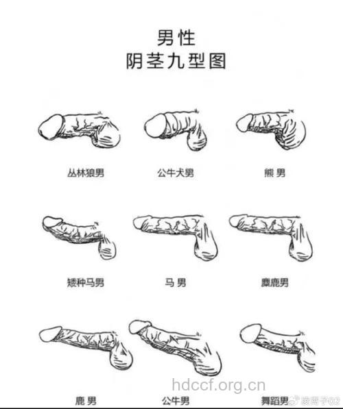 揭秘：男人爱整形哪些部位