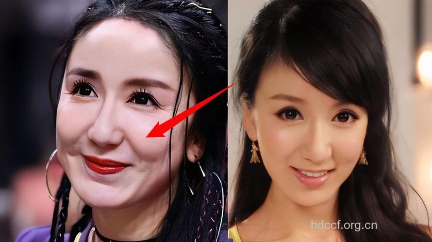 整形潮流：女明星常用整形术盘点