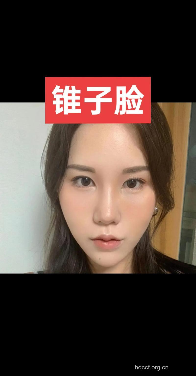 为何锥子脸会流行 如何整成锥子脸