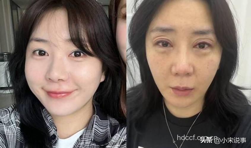 中国去年赴韩整形达5.6万人 哪些人容易整形失败