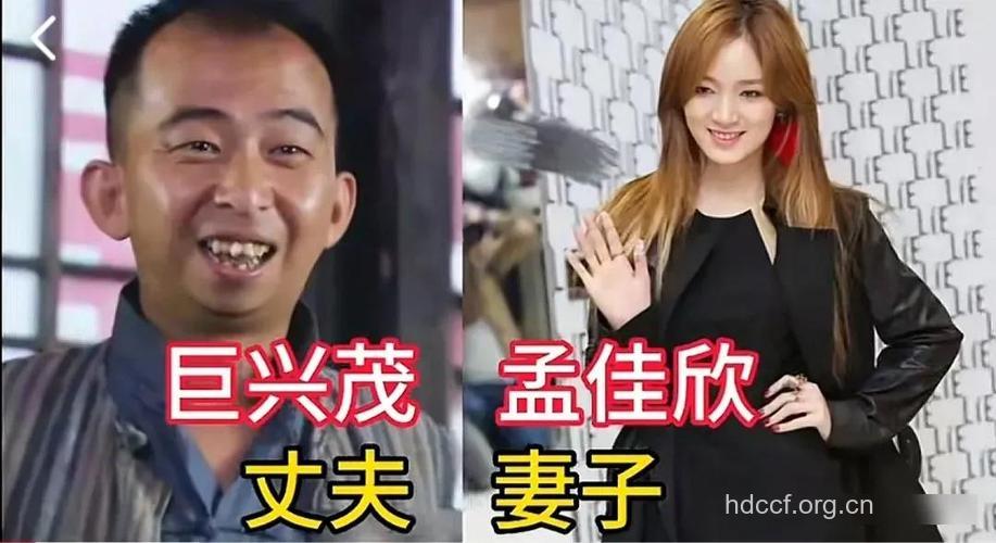 夫妻成整容狂人 整容的五大危害