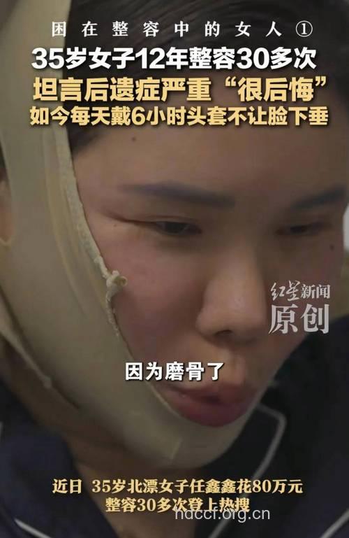 整容给中国女性带来痛苦