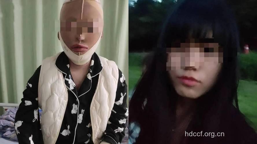 女子将男友毁容 女人吃什么会毁容