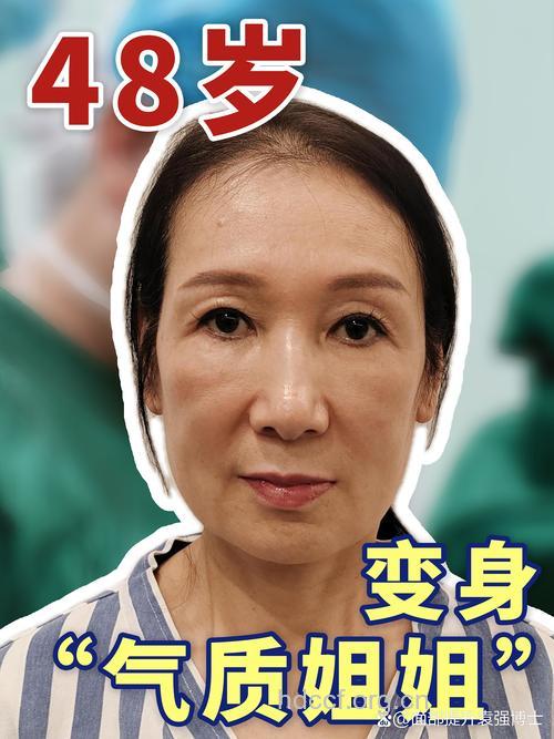 老了也要俏 中老年人整形热潮