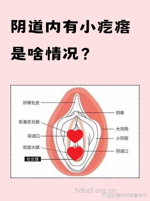 女性五种私处病症不能小看