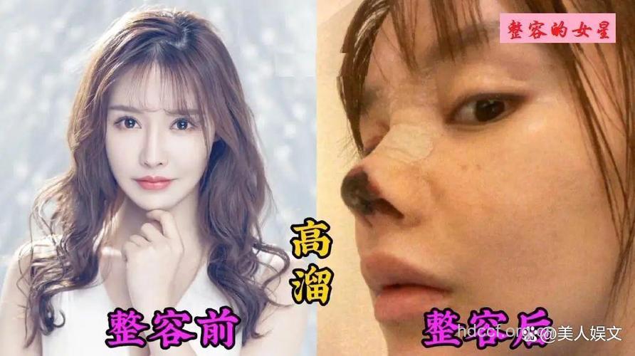 女子整容太美遭打 说说整容的五大危害