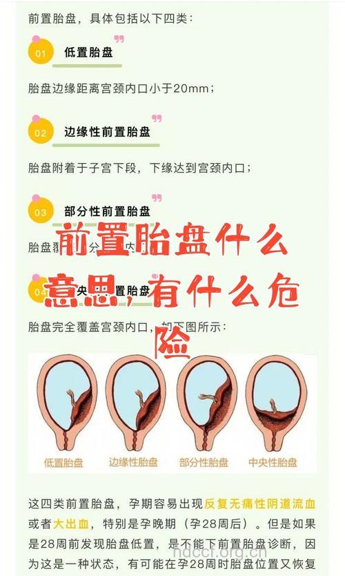 前置胎盘有哪些影响