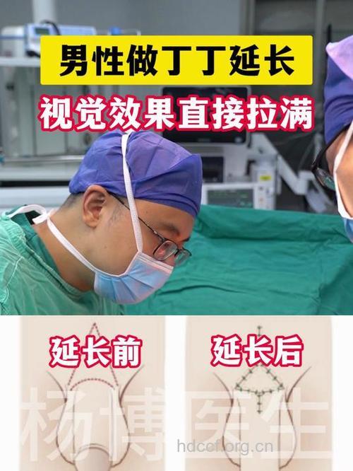 男人最需要整形的项目