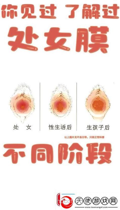 悲衰的人造处女膜
