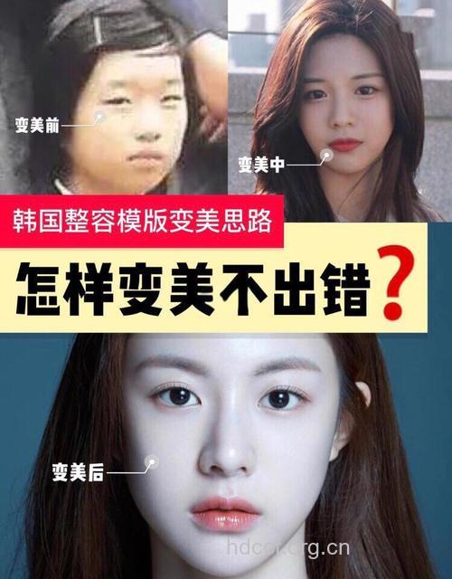 韩国人有一半我整形过