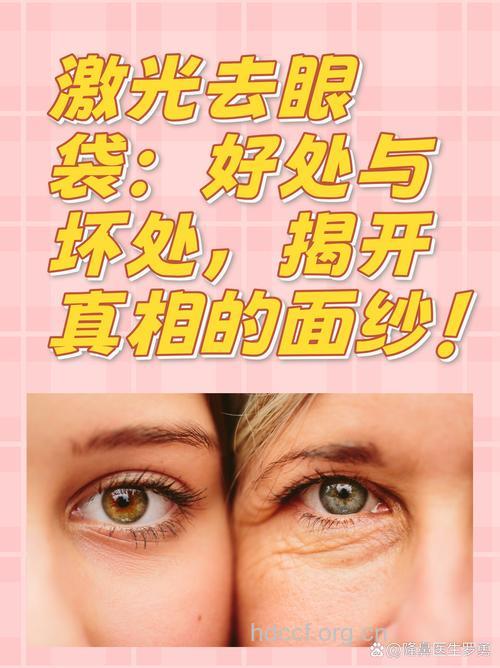 全面解读激光去眼袋 重返美丽双眸