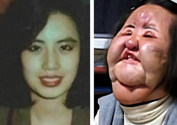 韩国女人整形成“疯”