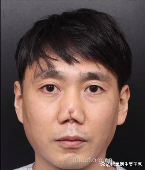 男士整容忠告