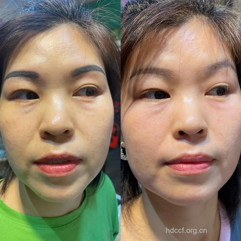 哪些方法让你不做黄脸婆
