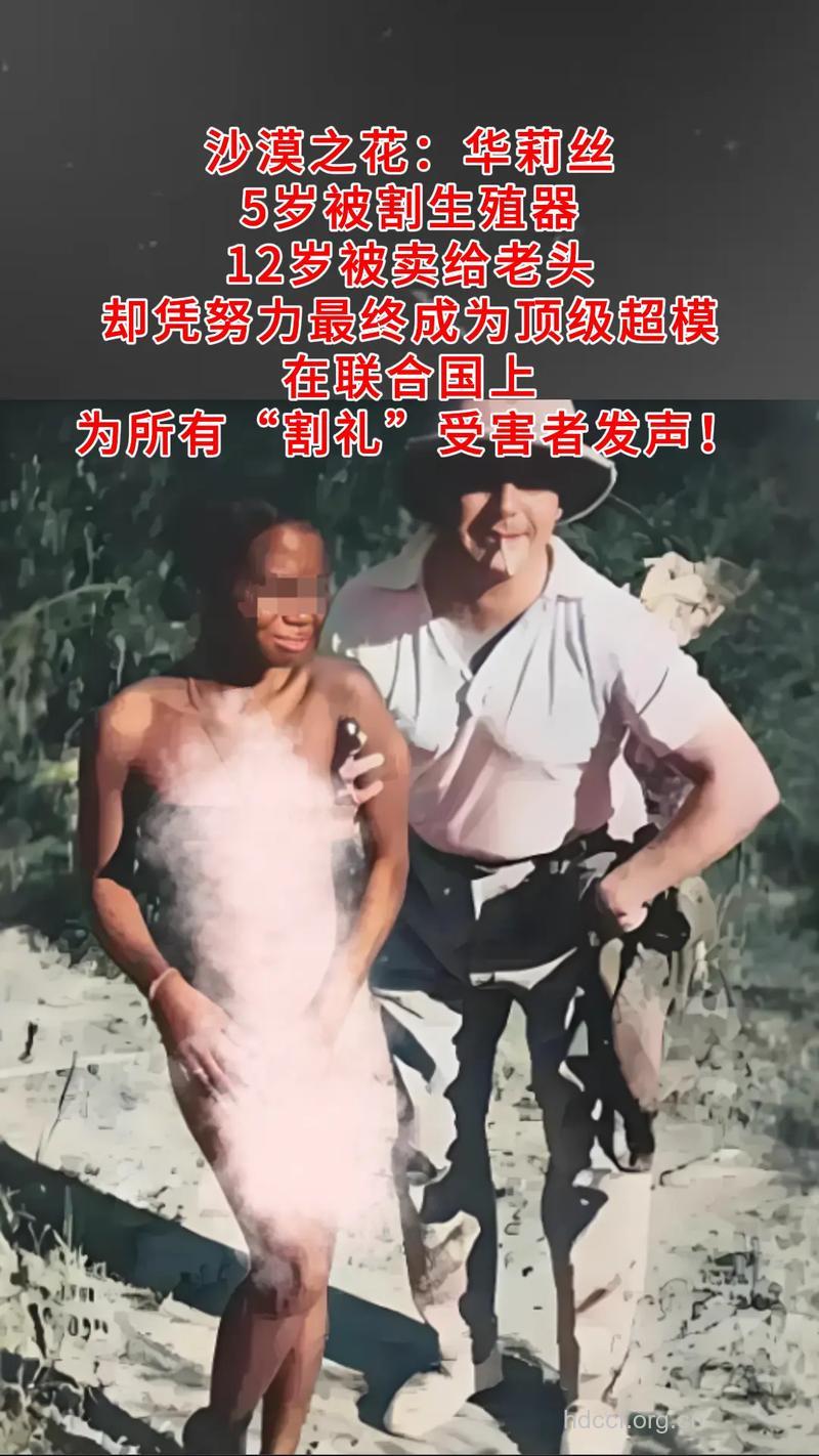 大龄丑女丰胸为何遭老公羞辱