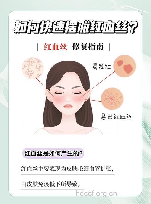 红血丝皮肤的护理建议和法则