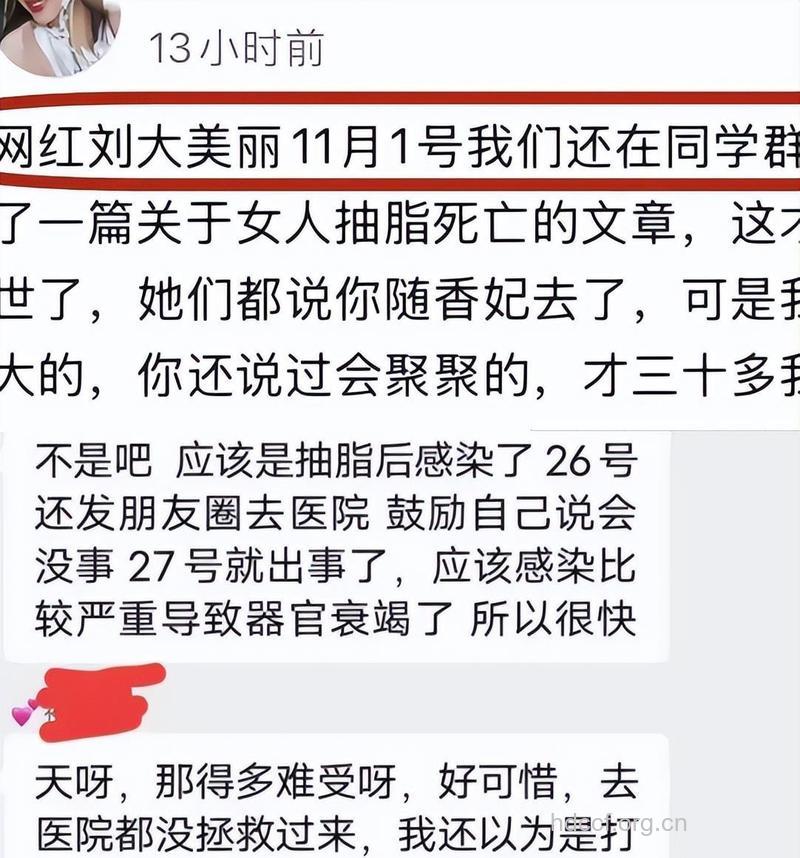 从超女王贝墓看整形风险