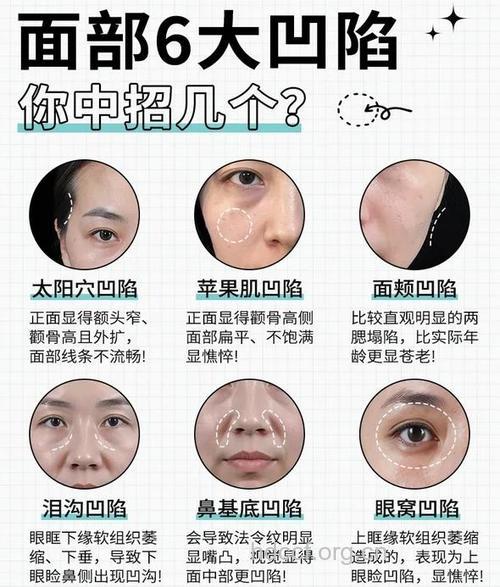 整形中哪些"能"哪些"不能"?