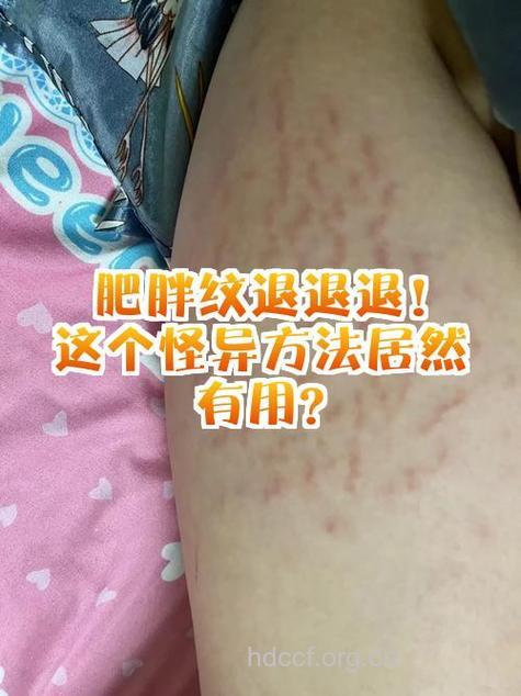 有哪些怪异方法能赶走皱纹