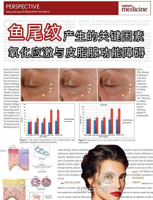 女性应该如何预防鱼尾纹 哪些原因会引起鱼尾纹