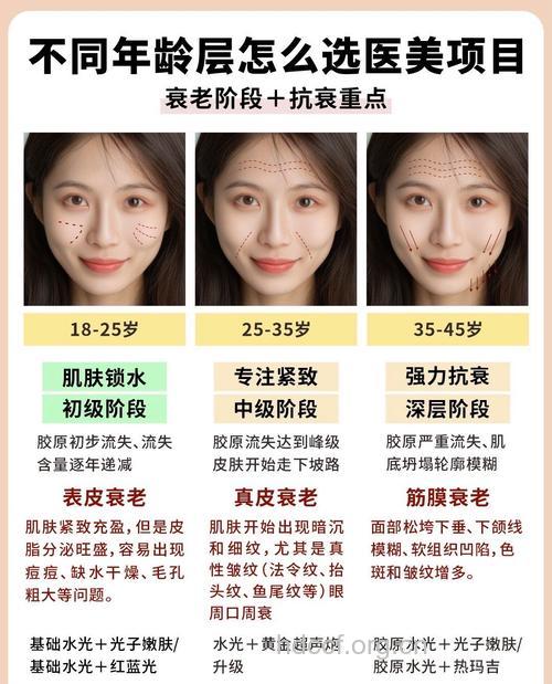 不同年龄段女人如何整形