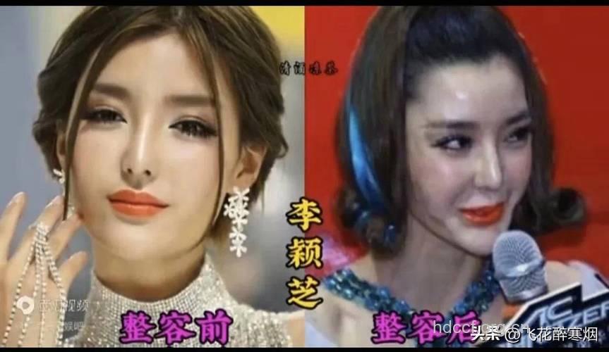 整容过度变蛇精 失败项目大盘点