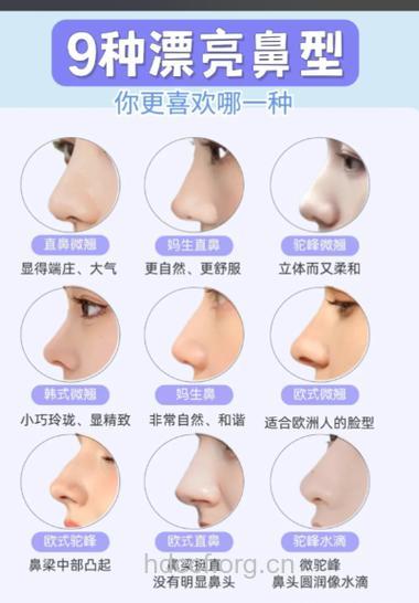 异体软骨隆鼻 你的不二选择